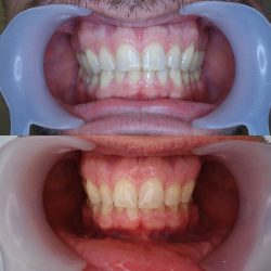 methode-therapie_myofonctionnelle-01